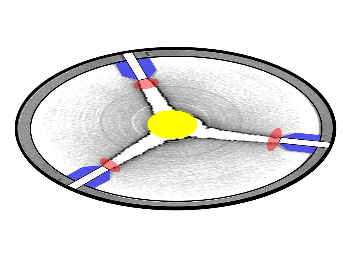 Horizontal CT-scan jet mill/nozzle-level.<sup>4</sup>