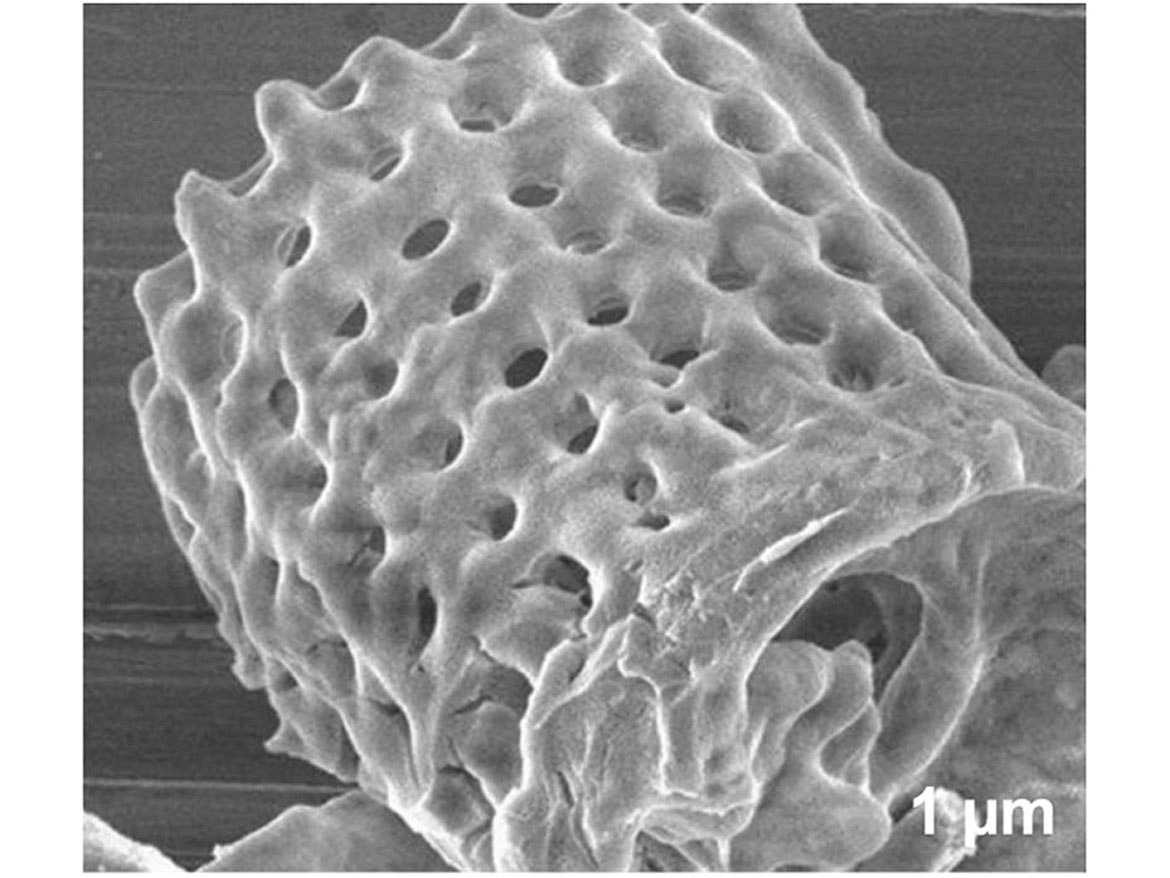 Diatom 10-50 microns.